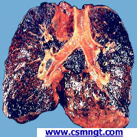 smokers lungs